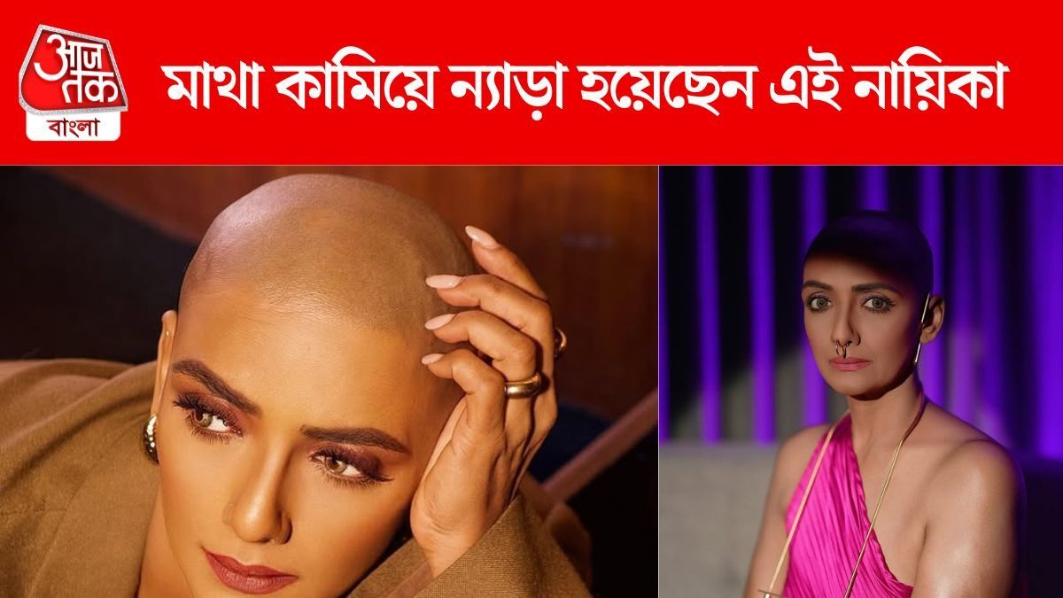 উধাও ঘন কালো লম্বা চুল, ন্যাড়া মাথার এই নায়িকাকে চেনেন? PHOTOS