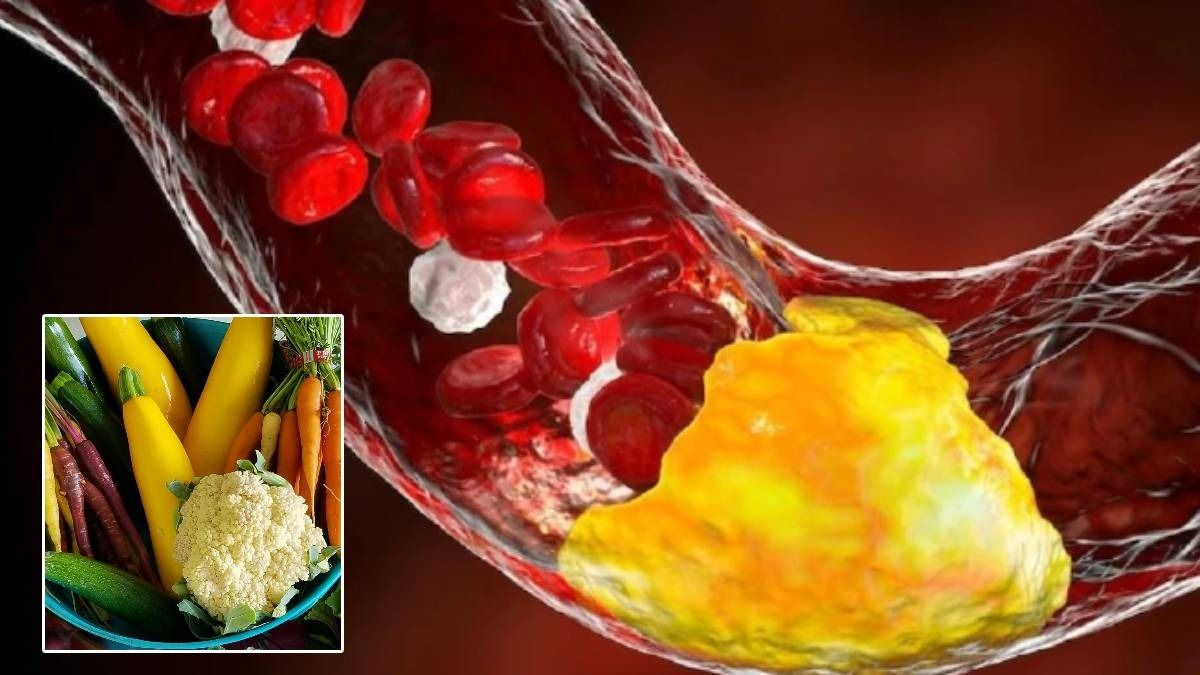 এলডিএল কোলেস্টেরল কমানোর সবজি