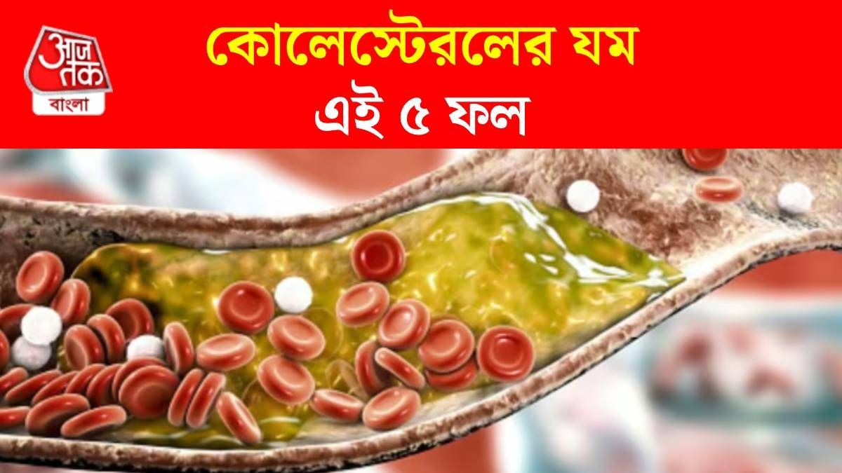 রক্তনালীতে জমে থাকা কোলেস্টেরলকে বের করবে ৫ ফল, রাখুন ডায়েটে