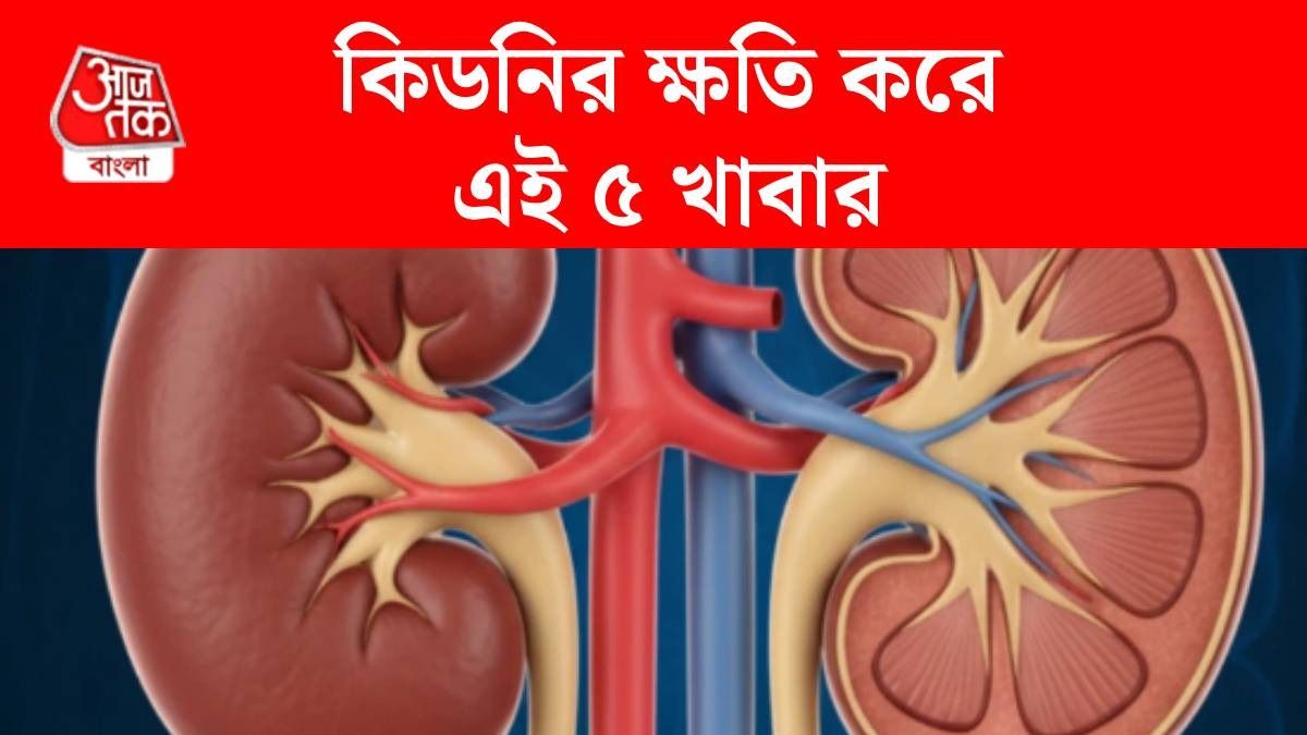 কিডনির জন্য ক্ষতিকর খাবার