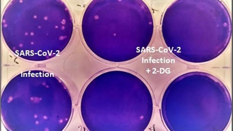 করোনায় নতুন ওষুধ আশা জাগাচ্ছে