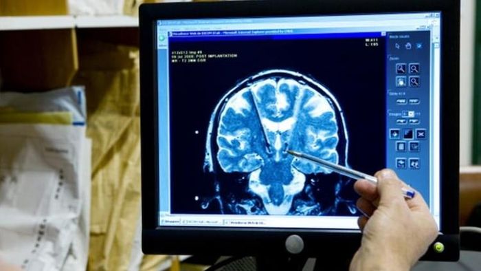 গ্রে ম্যাটার