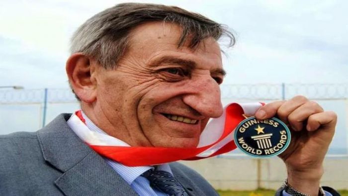 নাকের বিড়ম্বনা