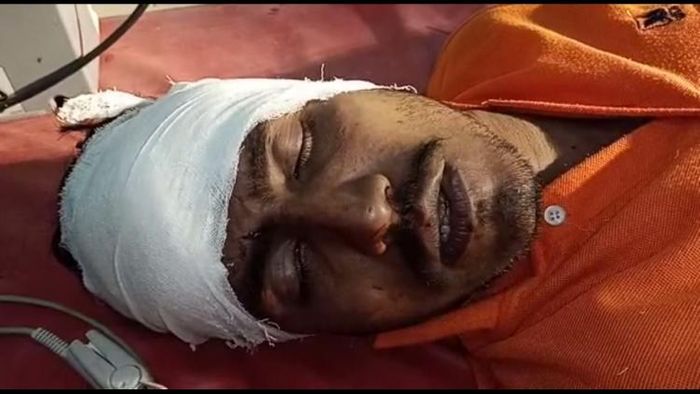 জমি বিবাদের জেরে আক্রান্ত