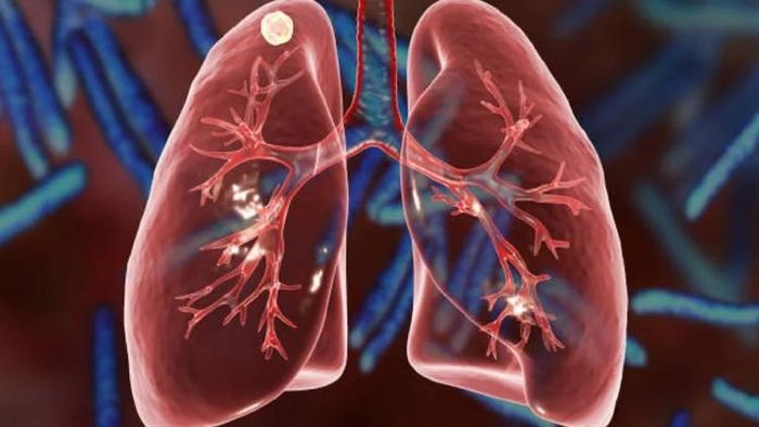 করোনা দূরে রাখতে সাধারণ টোটকা