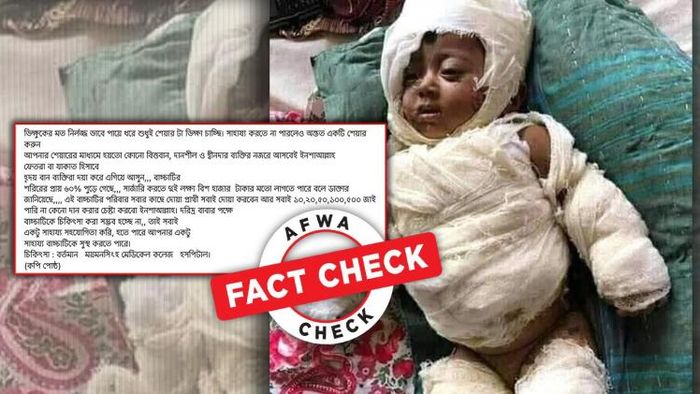 দুর্ঘটনায় আহত শিশুর ছবি-সহ সাহায্য চেয়ে আবেদন ভাইরাল হল ফেসবুকে