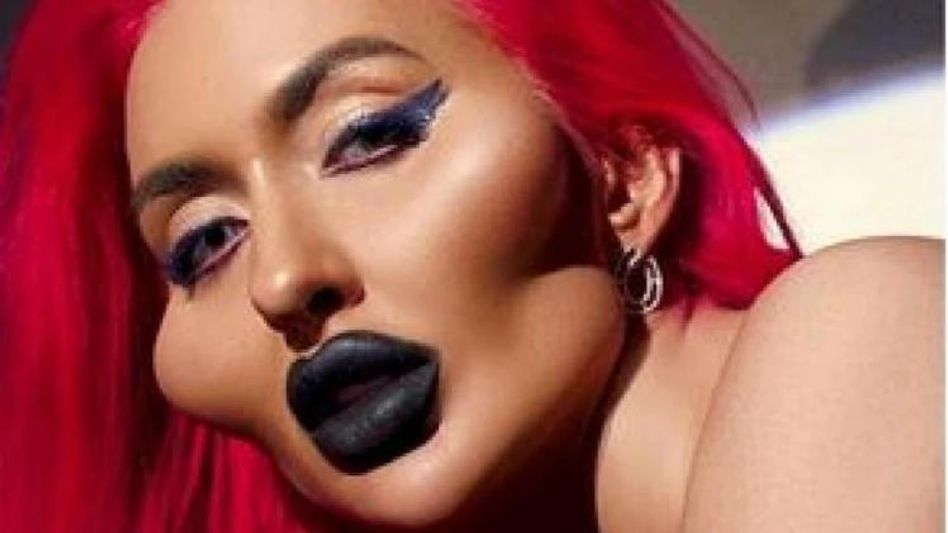 দুনিয়ার সবথেকে বড় গাল এই মডেলের, কী করে হল? দুনিয়ার সবথেকে বড় গাল এই মডেলের, কী করে হল?