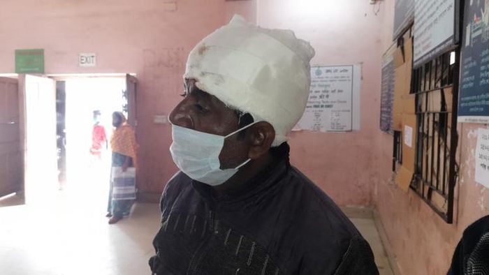 জখম বন্ধু