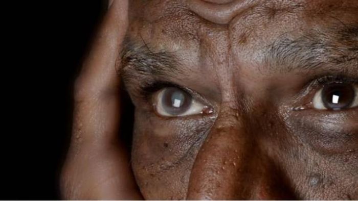 চোখের উপকার