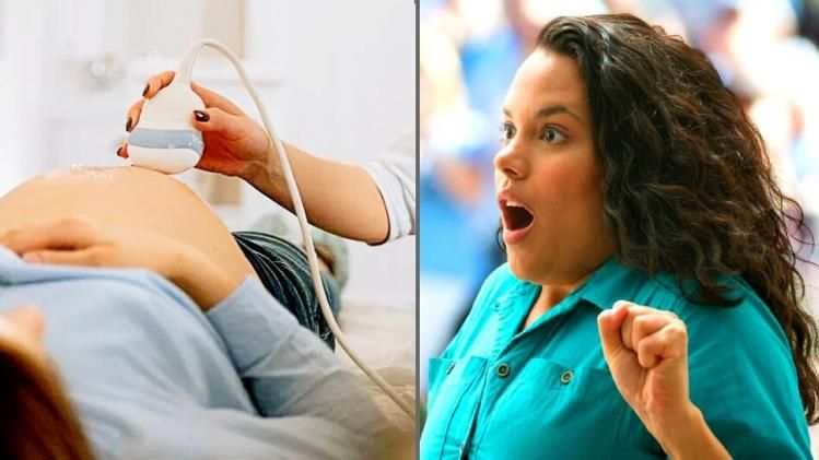 Samoxinaning yalangoch surati