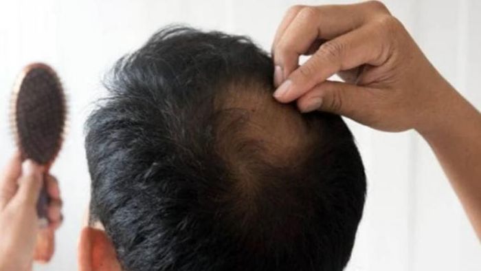 চুলের সমস্যা। প্রতীকী ছবি