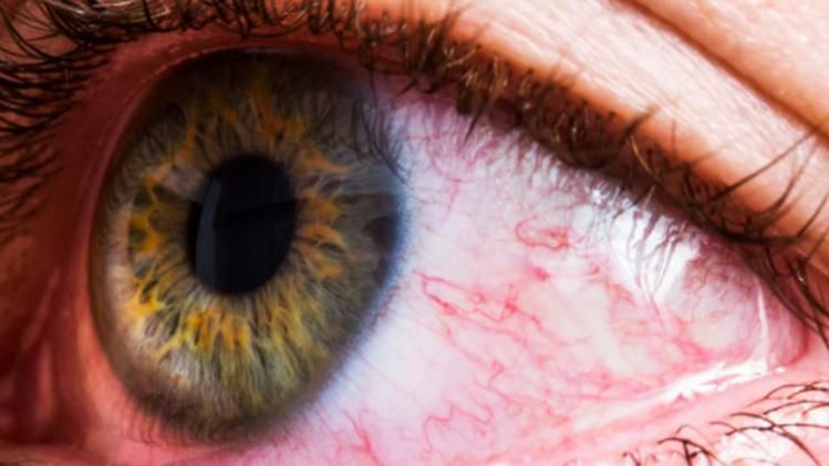 চোখ বলে দেয় কোন রোগে ভুগছেন আপনি, এই জিনিসগুলো লক্ষ্য করেছেন?