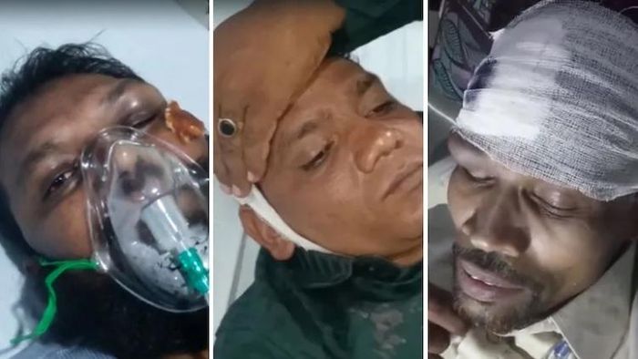 বিমান দুর্ঘটনায় আহত যাত্রীরা