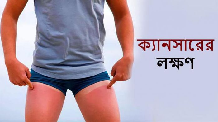 ক্যানসারের লক্ষণ।