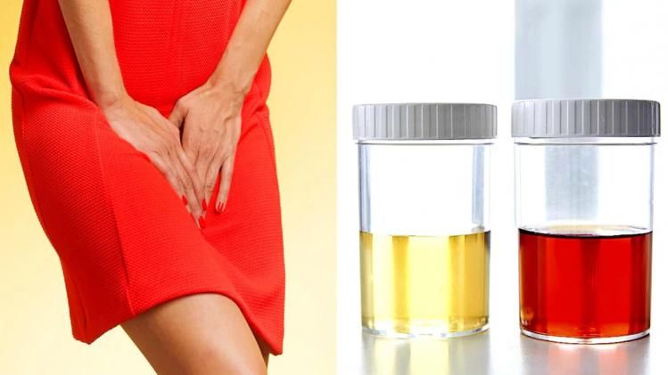 প্রস্রাবে এই সমস্যা? গুরুতর অসুখ বাসা বাঁধেনি তো!