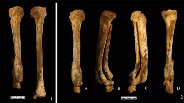 উদ্ধার হওয়া কঙ্কাল