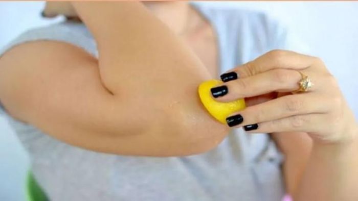 কনুই এবং হাঁটুর কালো দাগের সমস্যা সমাধানে ঘরোয়া উপায় (প্রতীকী ছবি)