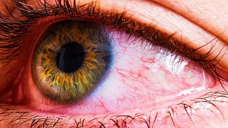 চোখ লাফাচ্ছে-ঝাপসা দেখছেন? উপেক্ষা করলে হারাতে পারেন দৃষ্টি