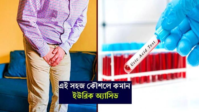 uric acid কমানোর উপায়।