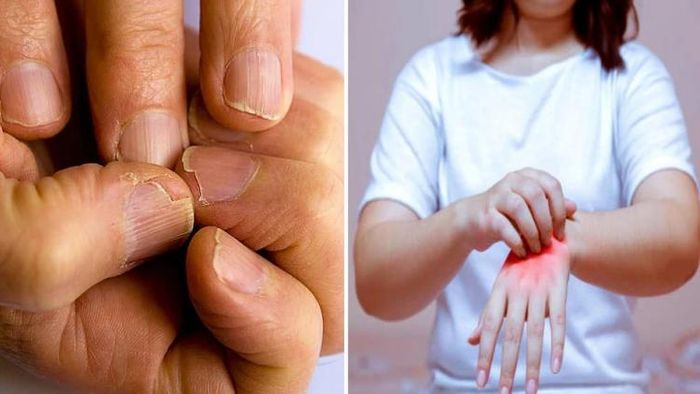 নখ দেখেই বোঝা যায় গভীর রোগের সঙ্কেত