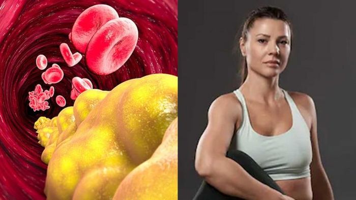 HEALTH TIPS: কোলেস্টেরল নিয়ন্ত্রণ করতে, যোগাসন করুন