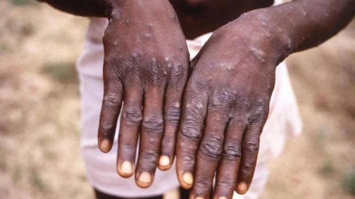 প্রতীকী ছবি