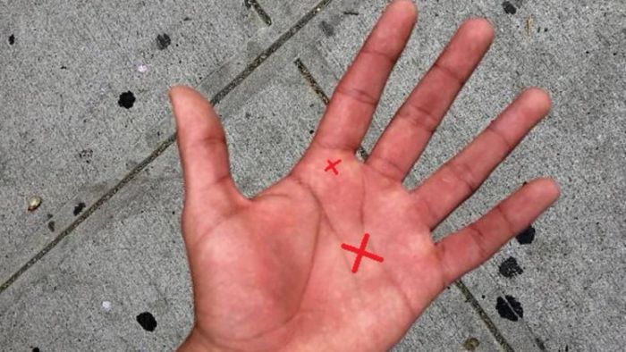 হাতের তালুতে কাটা চিহ্ন