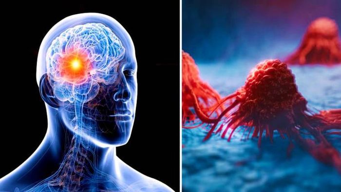 বেশিরভাগ ক্ষেত্রে বার্ধক্য এবং শরীরের রোগের কারণে পক্ষাঘাতের ঝুঁকি থাকে। তবে বর্তমানে তরুণদের মধ্যেও এই সমস্যা বাড়ছে।