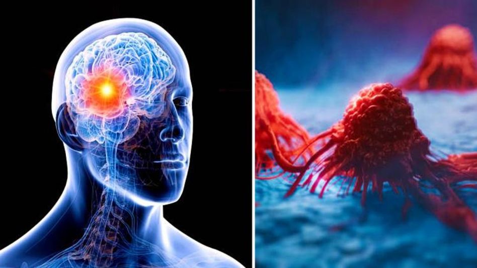 কাদের পক্ষাঘাতের ঝুঁকি বেশি? স্ট্রোকের আগাম লক্ষণগুলি চিনে নিন কাদের পক্ষাঘাতের ঝুঁকি বেশি? স্ট্রোকের আগাম লক্ষণগুলি চিনে নিন