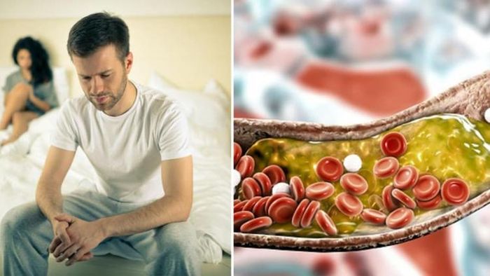 কোলেস্টেরল বাড়লে পুরুষত্বহীনতা!