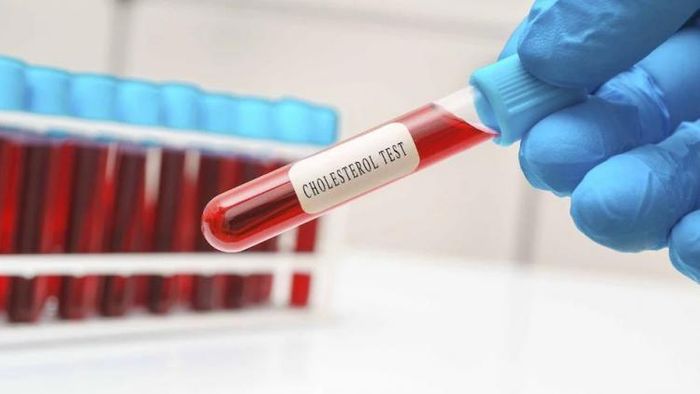 রক্তে কোলেস্টরল বাড়লে হার্ট অ্যাটাক হতে পারে