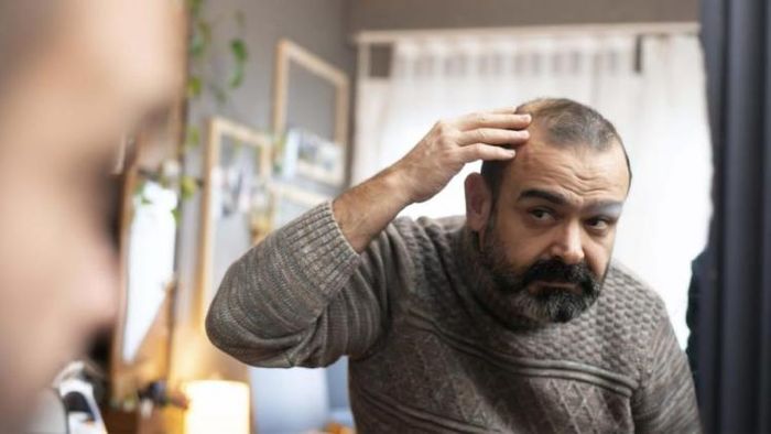 টাকে চুল গজানোর সহজ পদ্ধতি