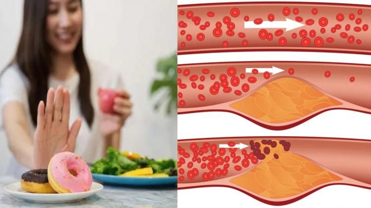 এই ৪ মুখরোচক খাবার বিষের সমান, কোলেস্টেরল কমাতে এখনই ছাড়ুন    