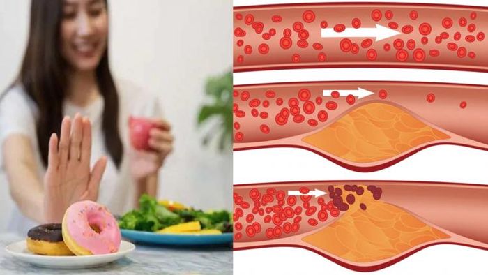 কোলেস্টেরল নিয়ন্ত্রণে রাখতে বাদ দিন ৪ খাবার।