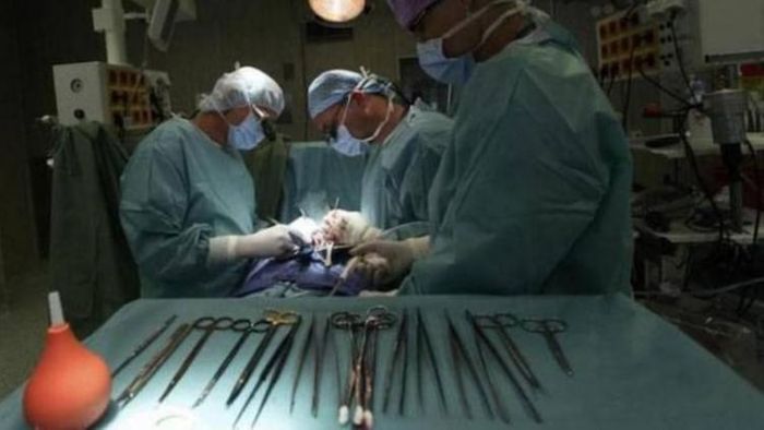 অপারেশনের সময় পেটের ভেতর রয়ে গেল ফোরসেপ