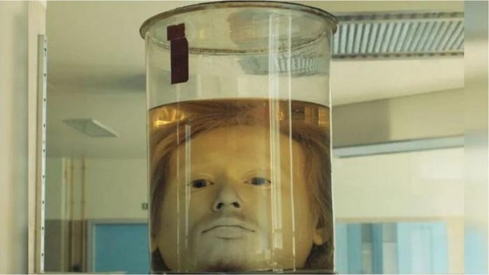 কাচের জারে ১৮১ বছর ধরে রাখা এই সিরিয়াল কিলারের মাথা, কেন?