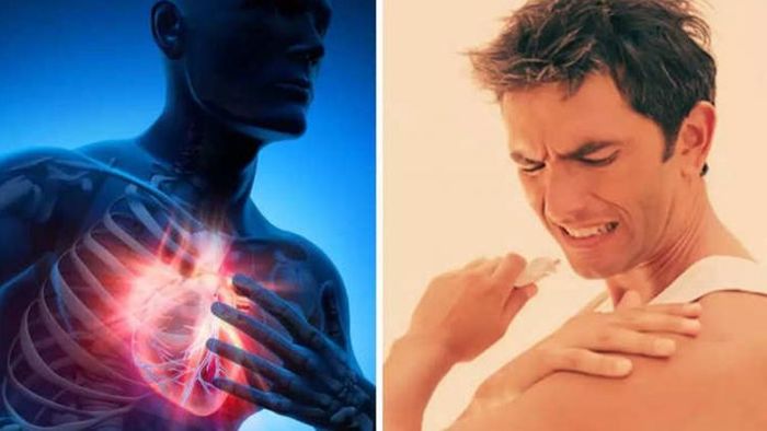 হার্ট অ্যাটাকের লক্ষণ
