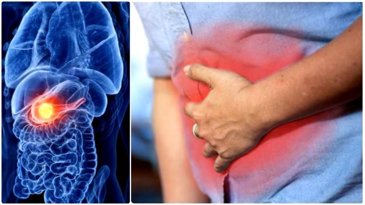 সর্বদা বদহজম-সুগার বাড়ছে-কমছে, অগ্ন্যাশয়ে ক্যান্সার পাকেনি তো? বোঝা যায়