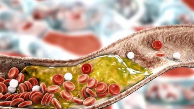 হাই কোলেস্টেরলে ভুগছেন? এই ৫টি জিনিস খেলেই কমবে চড়চড় করে