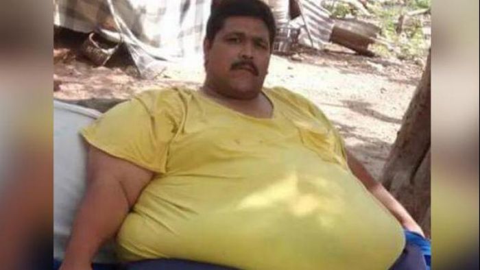 স্ত্রী ছেড়ে যেতেই শিকার হলেন হার্ট অ্যাটাকের