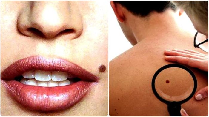 সমুদ্রশাস্ত্র অনুযায়ী, শরীরের বিভিন্ন অংশে থাকা তিলগুলি মানুষের জীবনের অনেক গোপন কথা বলে দিতে পারে।