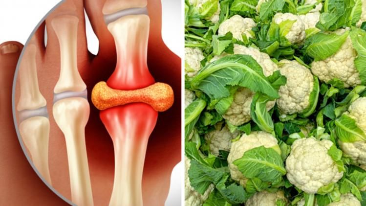 ইউরিক অ্যাসিড কমাতে যা খাবেন না।