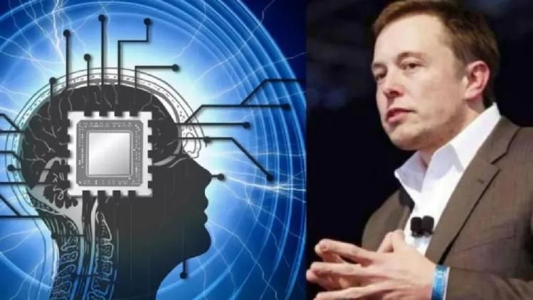 Elon Musk নিজের মাথায় লাগাবেন ব্রেন চিপ! এই Neuralink প্রোজেক্ট কী?