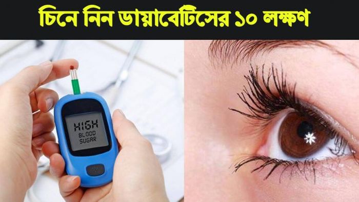 ডায়াবেটিসের ১০ লক্ষণ।