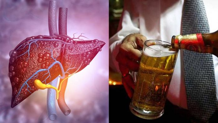 অ্যালকোহল থেকে লিভার পচতে শুরু করে, তারপরে এই ৬ টি প্রাথমিক লক্ষণ দেখা যায়