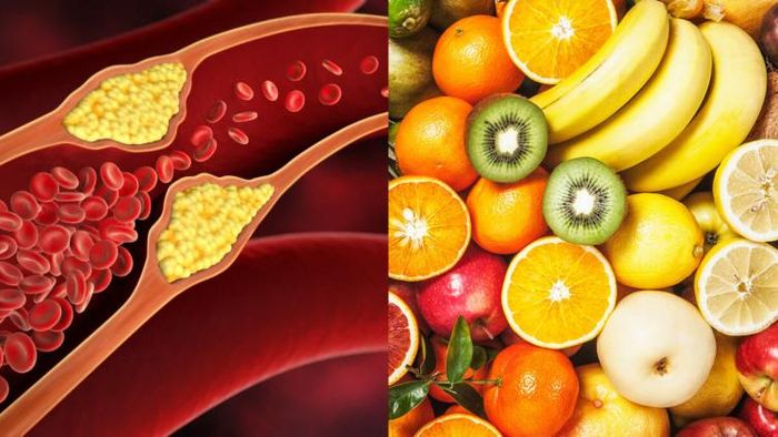 কোলেস্টেরলের মাত্রা কমাতে এই ফলগুলি আপনার খাদ্যতালিকায় অন্তর্ভুক্ত করুন