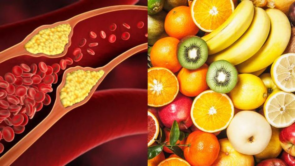 শরীর থেকে বেরিয়ে যাবে  খারাপ কোলেস্টেরল, ডায়েটে রাখুন এই ৫ ফল শরীর থেকে বেরিয়ে যাবে  খারাপ কোলেস্টেরল, ডায়েটে রাখুন এই ৫ ফল