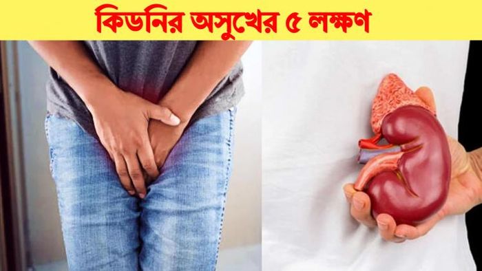 কিডনির অসুখের ৫ লক্ষণ।