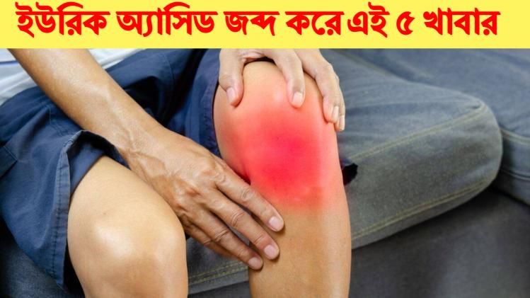 ইউরিক অ্যাসিডের প্রতিকার।