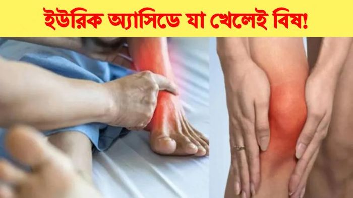 ইউরিক অ্যাসিডে যা খেলেই বিষ!